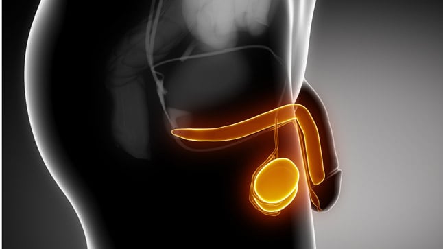 Causas, síntomas y tratamiento de la epididimitis