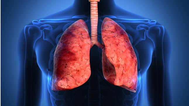 ¿Es contagiosa la fibrosis pulmonar?