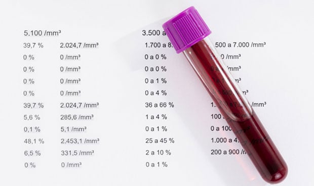 Tubo de análisis con sangre sobre una hoja con resultados del análisis