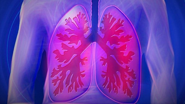 ¿Cómo se diagnostica la hipertensión pulmonar?