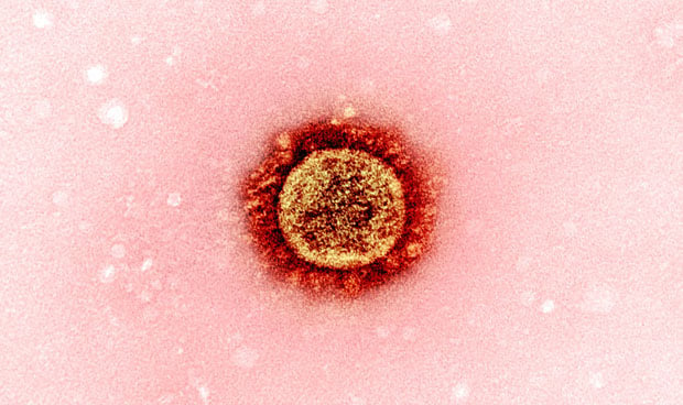 Imagen a microscopio del coronavirus