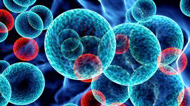 Causas, síntomas y tratamiento de la leucemia mieloblástica aguda