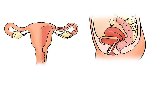 ¿Cómo se diagnostican los miomas?