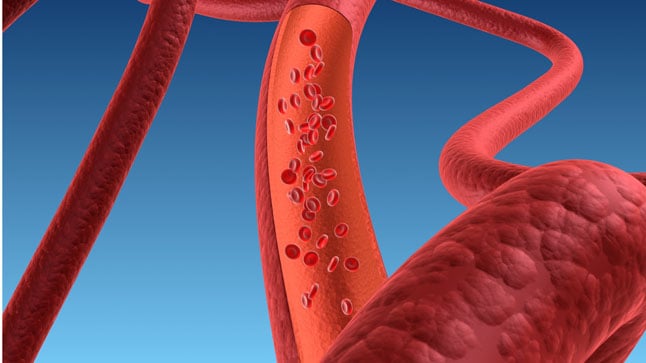 ¿Cómo se diagnostica la panarteritis nodosa?