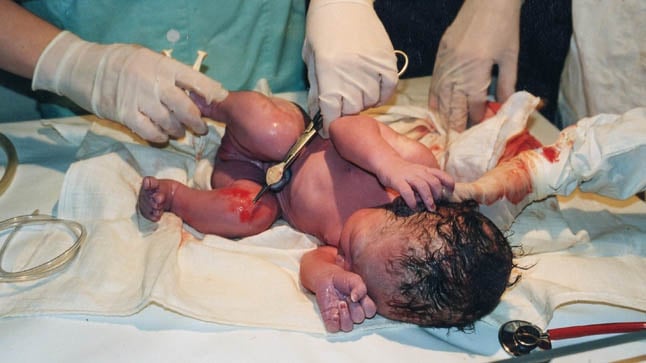 El parto: preparación, tipos y posibles complicaciones