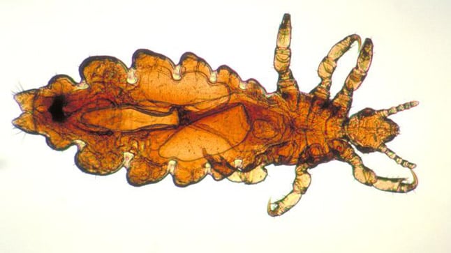 Piojo de la cabeza: causas, síntomas y tratamiento