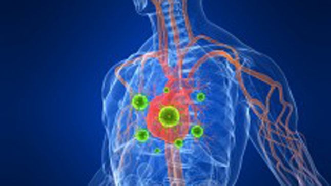 Profilaxis antibiótica en endocarditis infecciosa