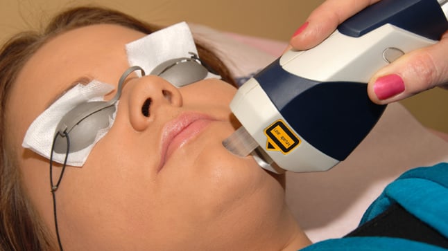 ordenar antena ladrar Rejuvenecimiento facial con láser | Redacción Médica