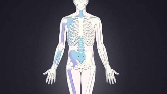 Tipos, causas y tratamiento de los sarcomas de tejidos blandos