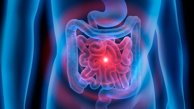  ¿Cuál es el pronóstico del síndrome del intestino corto?
