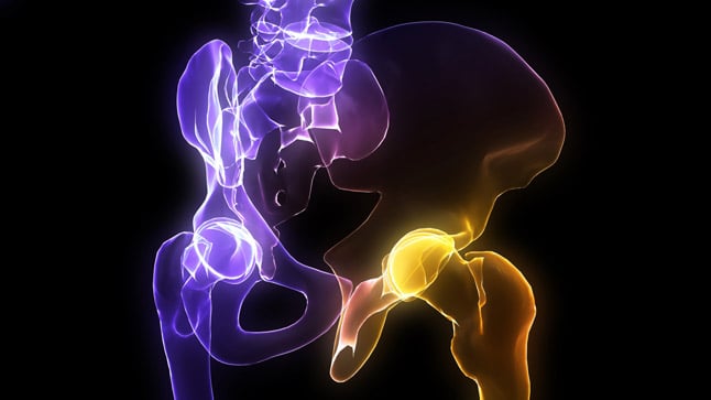 ¿Cómo se diagnostica la sinovitis transitoria de cadera?