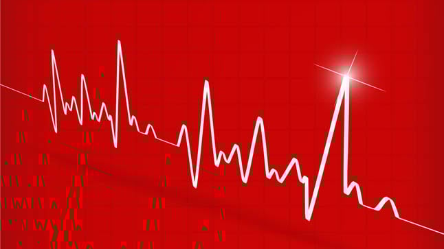 ¿Cómo se diagnostica la taquicardia supraventricular?