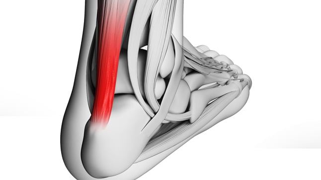 ¿Cómo se diagnostican las tendinitis?