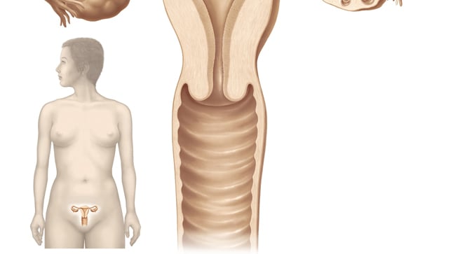 ¿Cómo se diagnostica una vulvovaginitis?