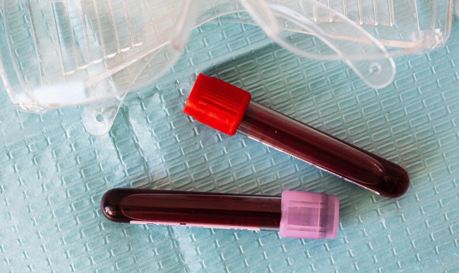 ¿Se puede donar sangre con la regla?