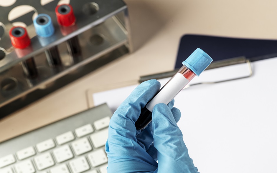 Normas para donar sangre en España
