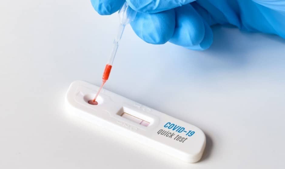 ¿Son efectivos y tienen fiabilidad los test de antígenos de la farmacia?